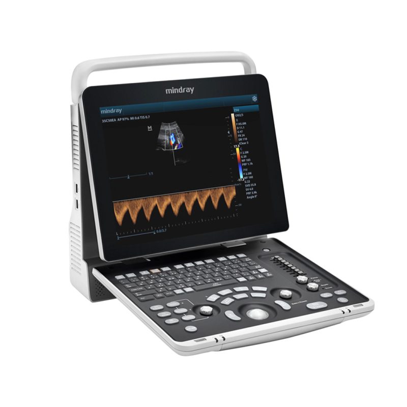 Ecografo portatile Mindray Z50 con tecnologia avanzata e design compatto